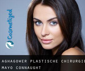 Aghagower plastische chirurgie (Mayo, Connaught)