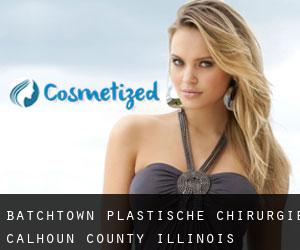 Batchtown plastische chirurgie (Calhoun County, Illinois)