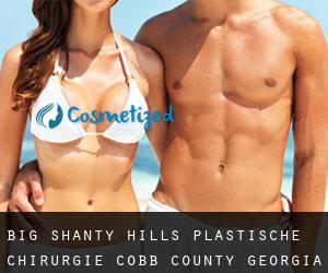 Big Shanty Hills plastische chirurgie (Cobb County, Georgia)