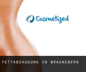 Fettabsaugung in Brauneberg
