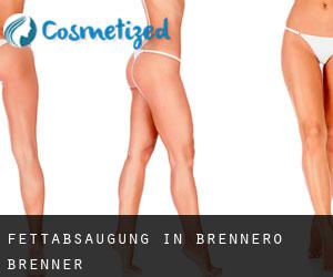 Fettabsaugung in Brennero - Brenner