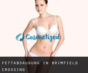 Fettabsaugung in Brimfield Crossing