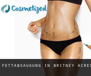 Fettabsaugung in Britney Acres