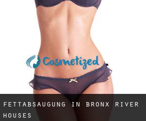 Fettabsaugung in Bronx River Houses