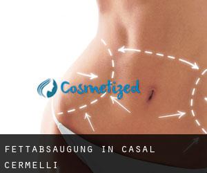Fettabsaugung in Casal Cermelli