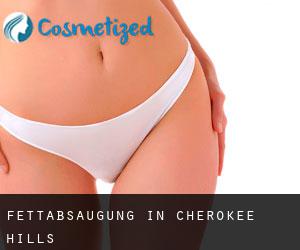 Fettabsaugung in Cherokee Hills