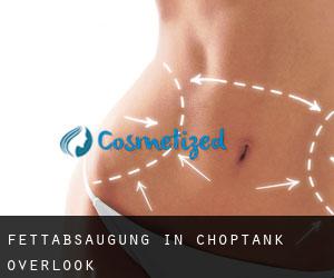Fettabsaugung in Choptank Overlook