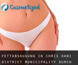 Fettabsaugung in Chris Hani District Municipality durch metropole - Seite 4