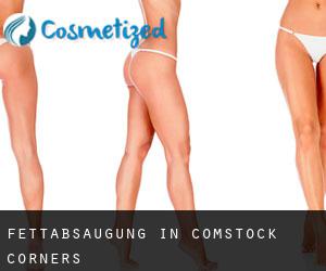 Fettabsaugung in Comstock Corners