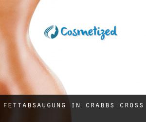 Fettabsaugung in Crabbs Cross