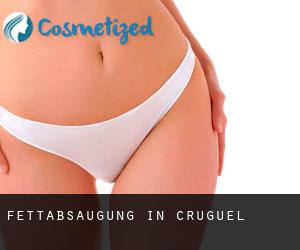 Fettabsaugung in Cruguel