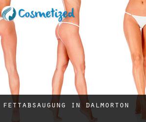 Fettabsaugung in Dalmorton