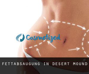 Fettabsaugung in Desert Mound