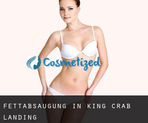 Fettabsaugung in King Crab Landing