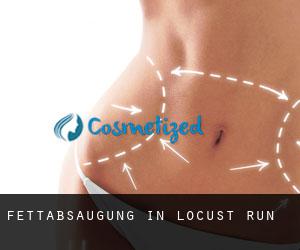 Fettabsaugung in Locust Run