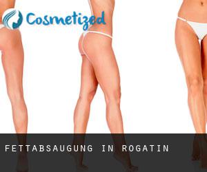 Fettabsaugung in Rogatin