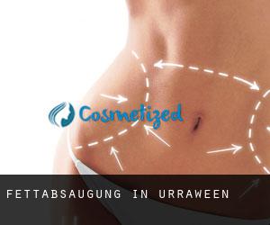 Fettabsaugung in Urraween