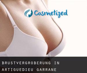 Brustvergrößerung in Artiguedieu-Garrané