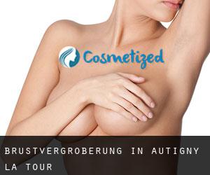 Brustvergrößerung in Autigny-la-Tour