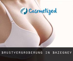 Brustvergrößerung in Bazegney