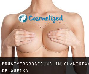 Brustvergrößerung in Chandrexa de Queixa