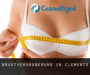 Brustvergrößerung in Clements