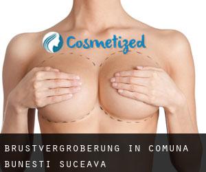 Brustvergrößerung in Comuna Buneşti (Suceava)