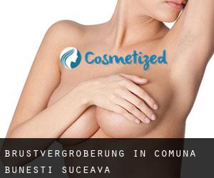 Brustvergrößerung in Comuna Buneşti (Suceava)