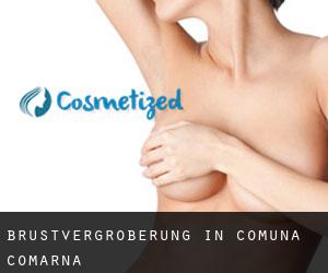 Brustvergrößerung in Comuna Comarna