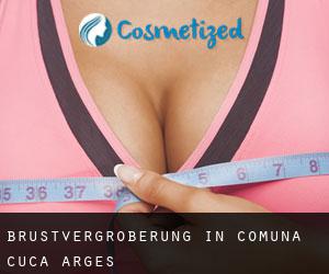 Brustvergrößerung in Comuna Cuca (Argeş)