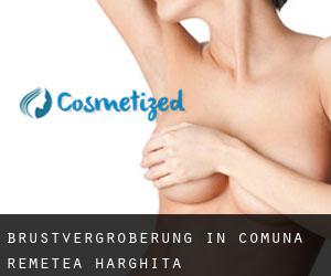 Brustvergrößerung in Comuna Remetea (Harghita)
