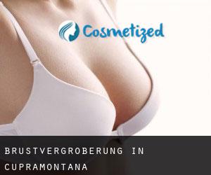 Brustvergrößerung in Cupramontana