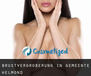 Brustvergrößerung in Gemeente Helmond
