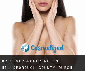 Brustvergrößerung in Hillsborough County durch stadt - Seite 3