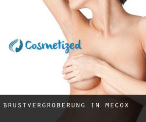 Brustvergrößerung in Mecox