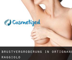 Brustvergrößerung in Ortignano Raggiolo