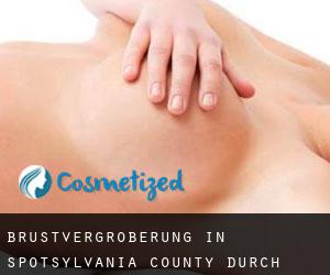 Brustvergrößerung in Spotsylvania County durch hauptstadt - Seite 2