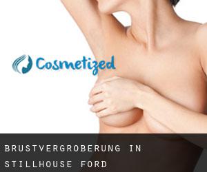 Brustvergrößerung in Stillhouse Ford