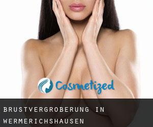 Brustvergrößerung in Wermerichshausen