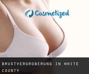 Brustvergrößerung in White County