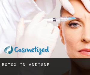 Botox in Andigné