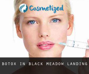 Botox in Black Meadow Landing