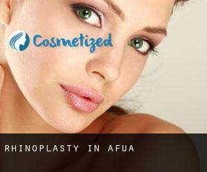 Rhinoplasty in Afuá