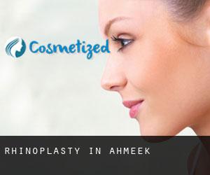 Rhinoplasty in Ahmeek