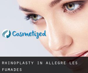 Rhinoplasty in Allègre-les-Fumades