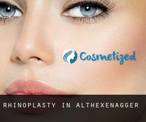 Rhinoplasty in Althexenagger
