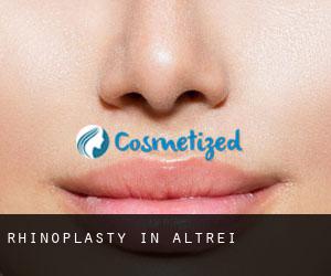 Rhinoplasty in Altrei