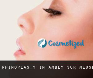 Rhinoplasty in Ambly-sur-Meuse