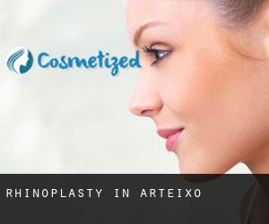 Rhinoplasty in Arteixo