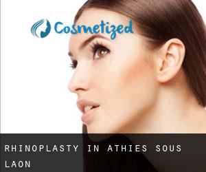Rhinoplasty in Athies-sous-Laon